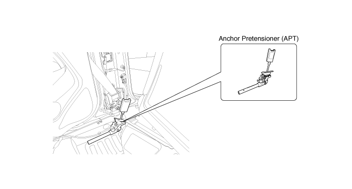Anchor Pretensioner (APT) Removal
